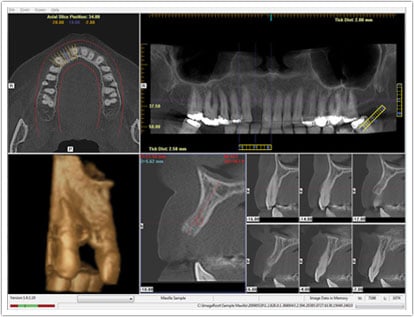 computer imaging and x-rays of teeth